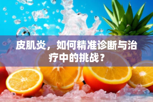 皮肌炎，如何精准诊断与治疗中的挑战？